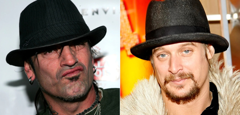 Tommy Lee (Mötley Crüe) conta detalhes da treta com Kid Rock em 2007: “Houve um ou outro soco que não acertou”